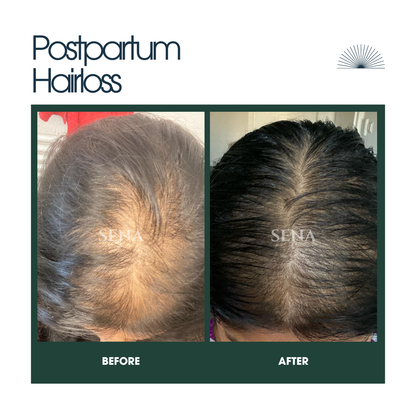 RootVeda Oil | Natural Hair Oil for Hair Fall & Scalp Nourishment