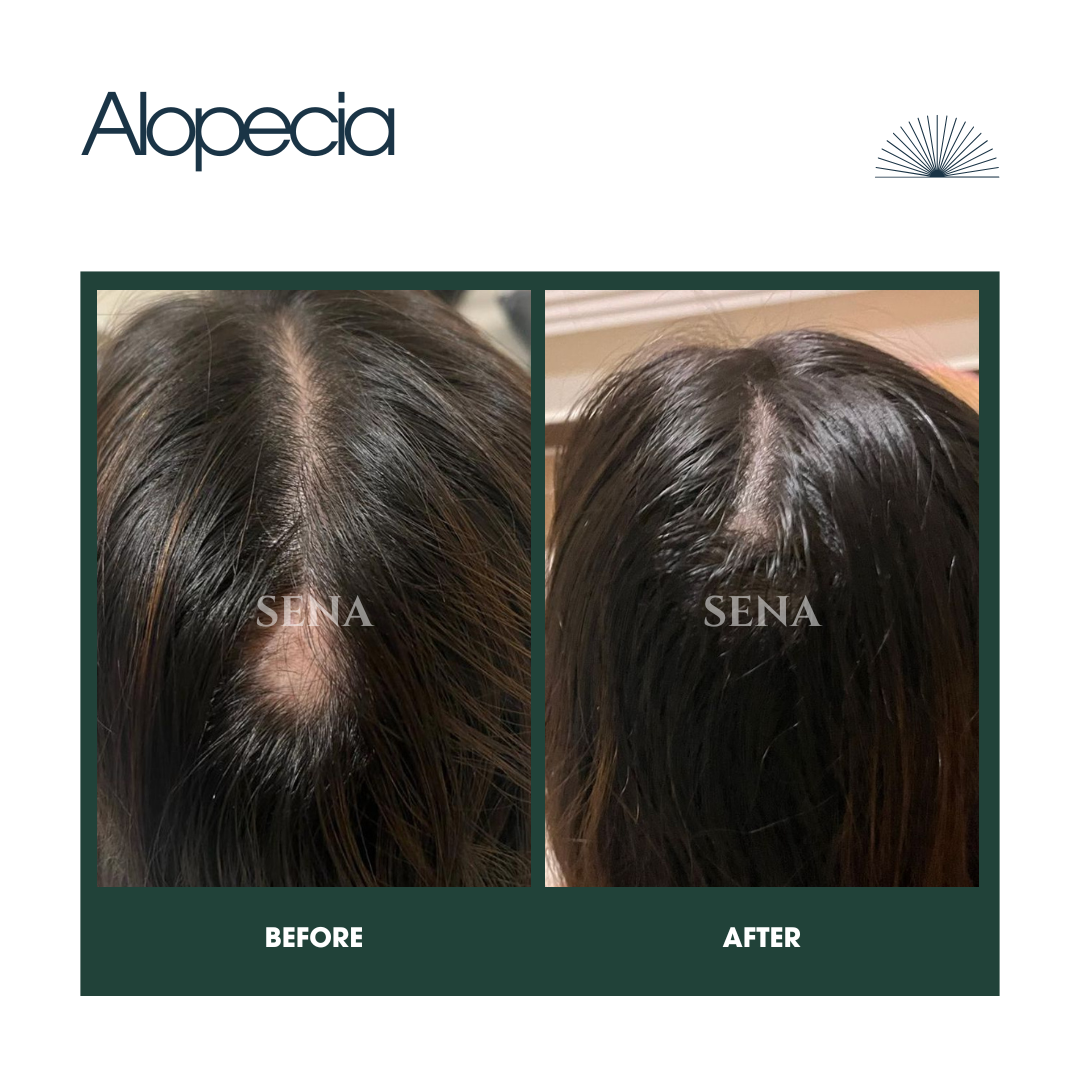 Deep Nourish Hair Repair Set (3-Step) | FULL GROWTH CYCLE