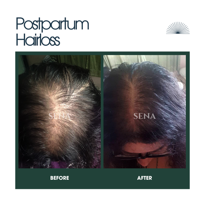 Ultimate Hair Regrowth System (4-Step)