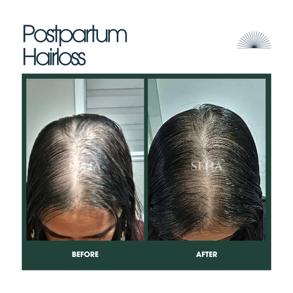 Scalp Balance & Growth Duo