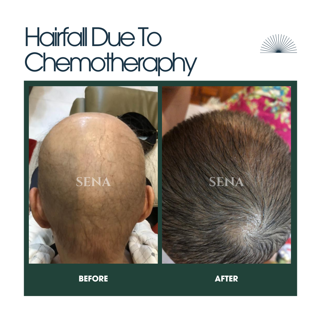 Scalp Balance & Growth Duo