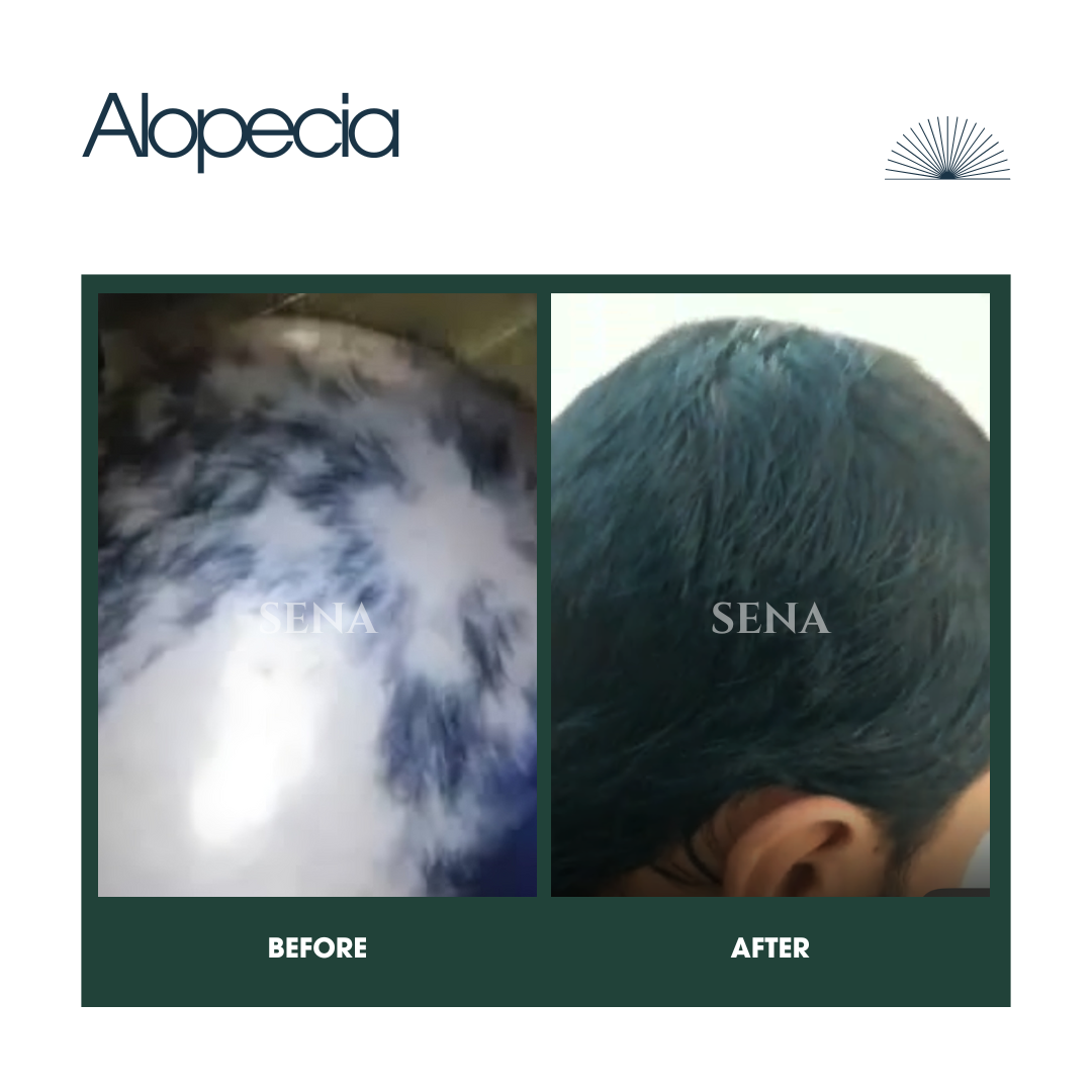Scalp Balance & Regrowth Set