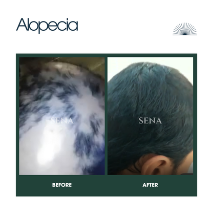 Scalp Balance & Regrowth Set