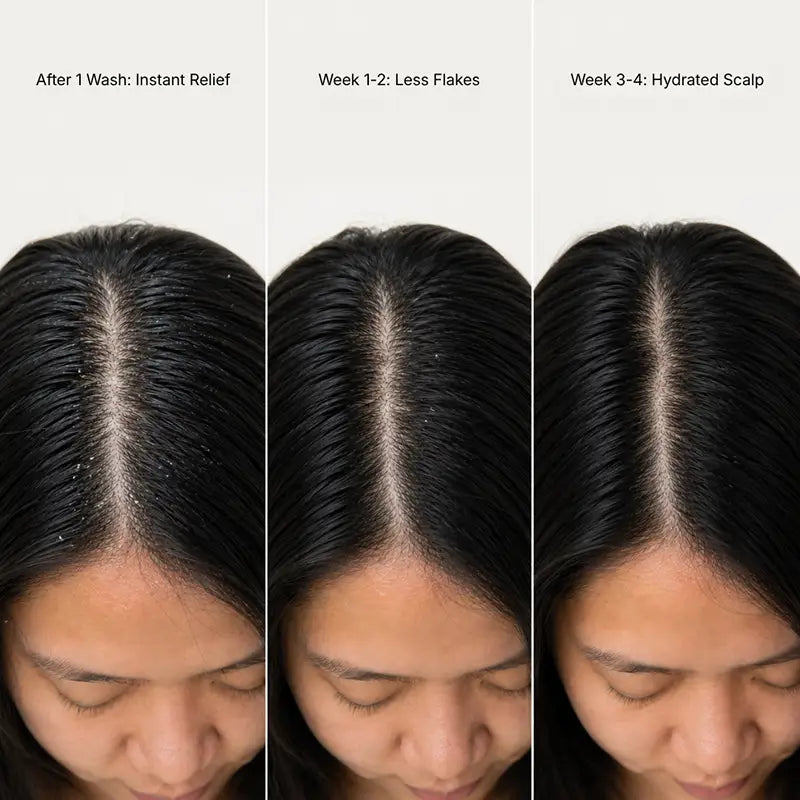 RootGuard Dry Scalp Shampoo