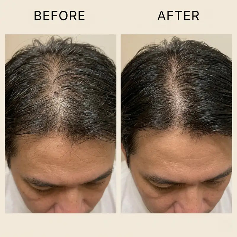 RootVeda Oil