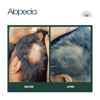 RootVeda Oil | Natural Hair Oil for Hair Fall & Scalp Nourishment