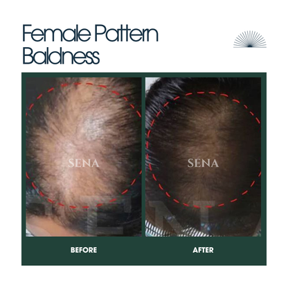 Scalp Balance & Growth Duo