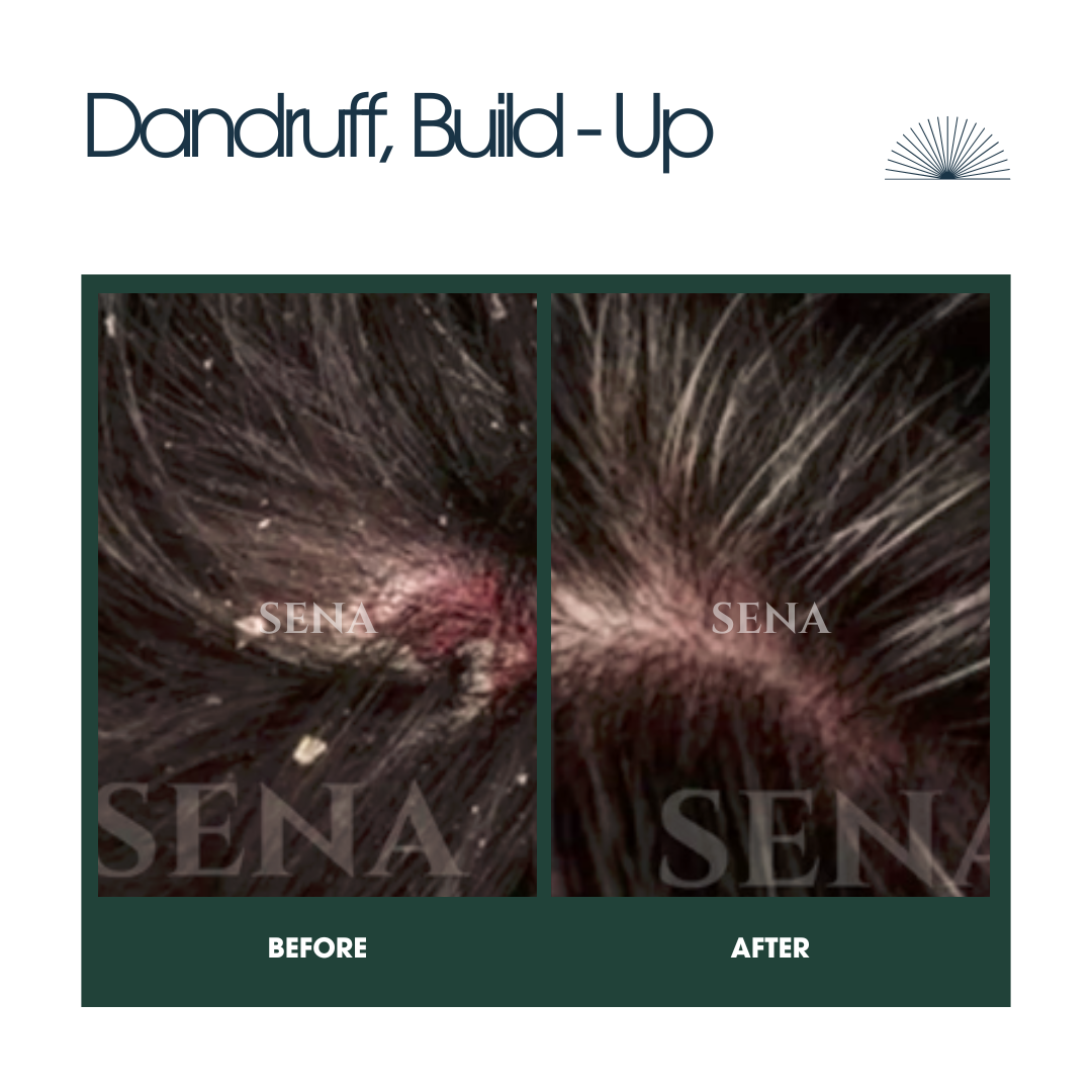 Scalp Balance & Regrowth Set