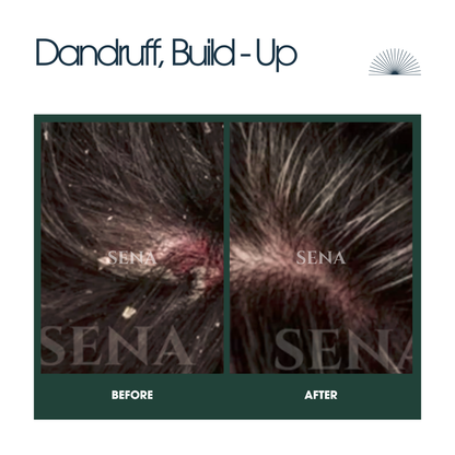 Scalp Balance & Regrowth Set