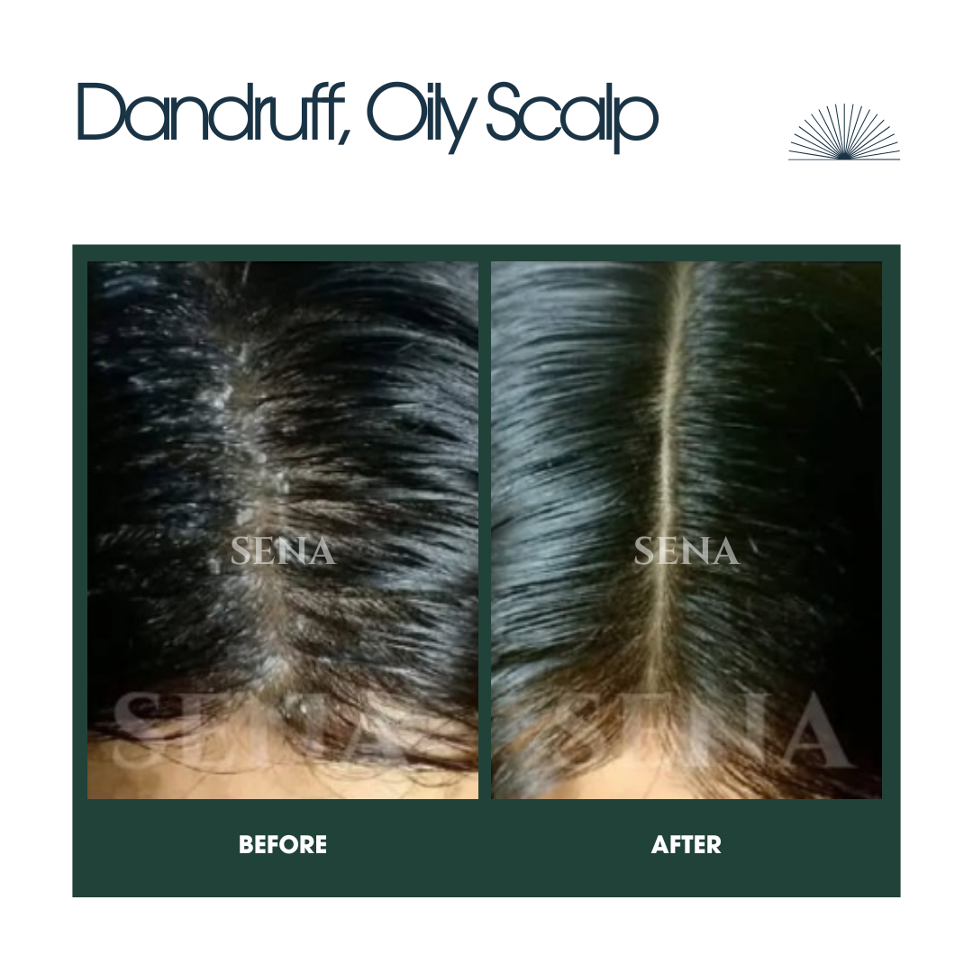 RootGuard Oily Scalp Shampoo