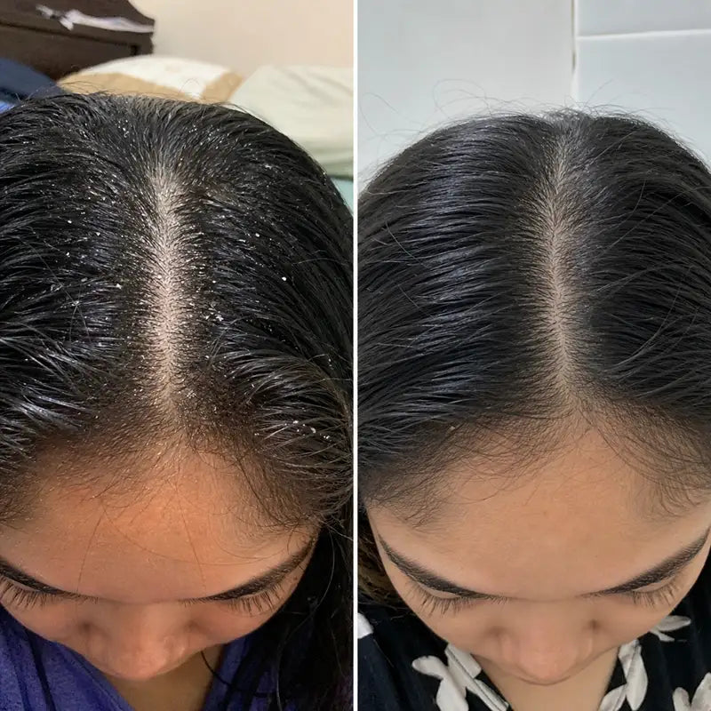 RootGuard Dry Scalp Shampoo