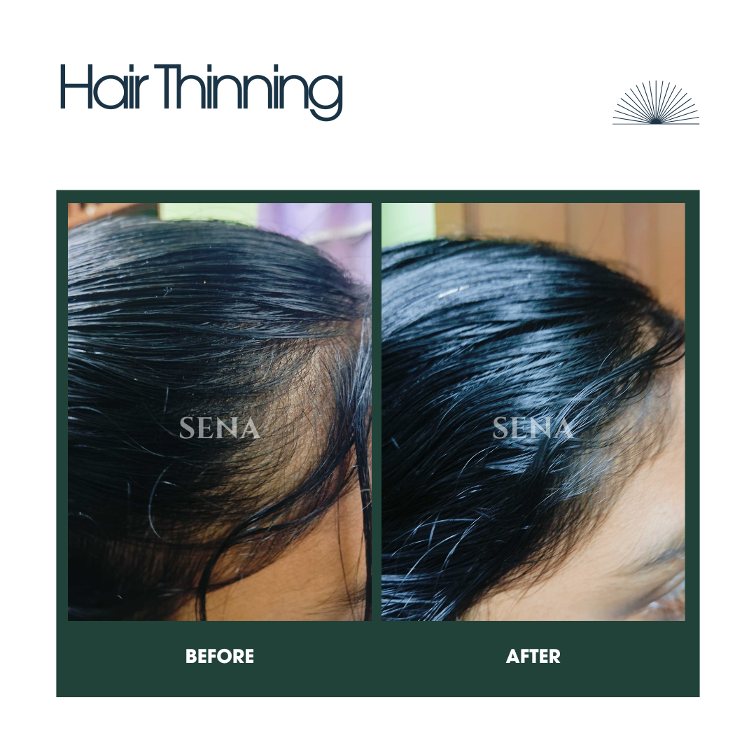 Scalp Balance & Regrowth Set