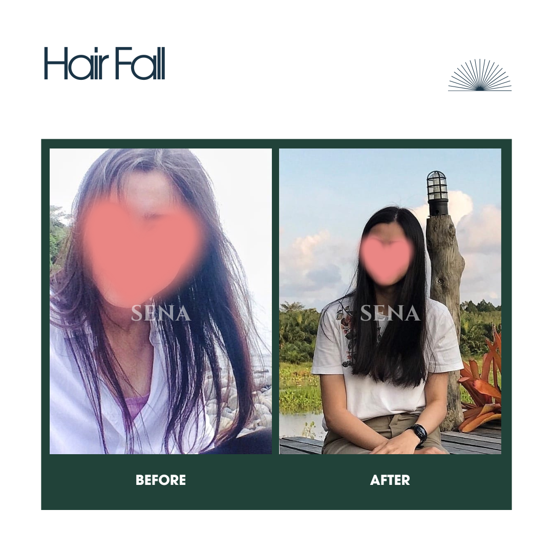 RootRecovery Tonic | Clinically Proven Hair Growth Tonic