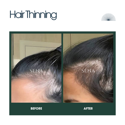 Scalp Balance & Regrowth Set