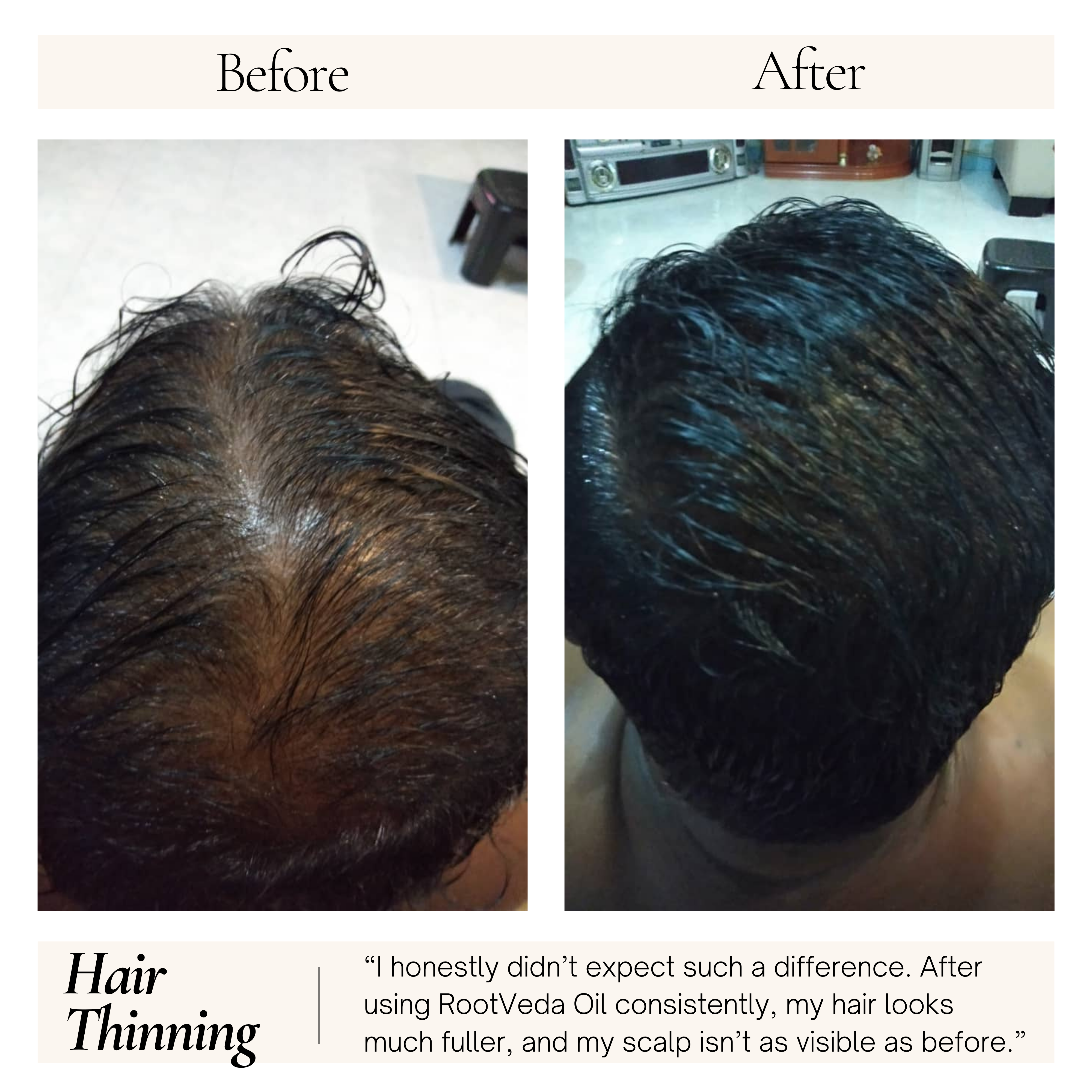 RootVeda Oil