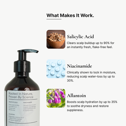 RootGuard Shampoo | Dry Scalp Shampoo for Intense Hydration & Scalp Comfort