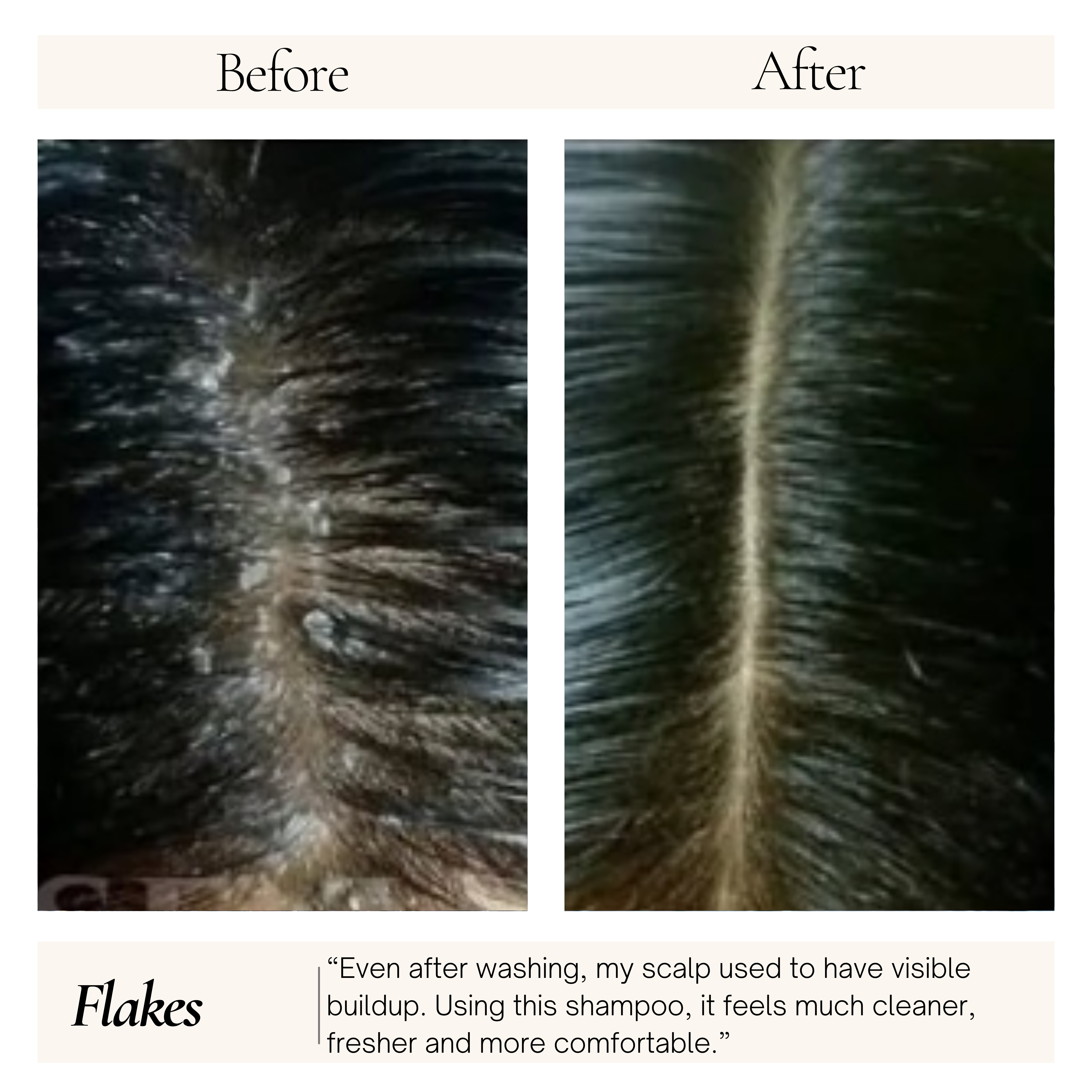RootGuard Shampoo Dry Scalp