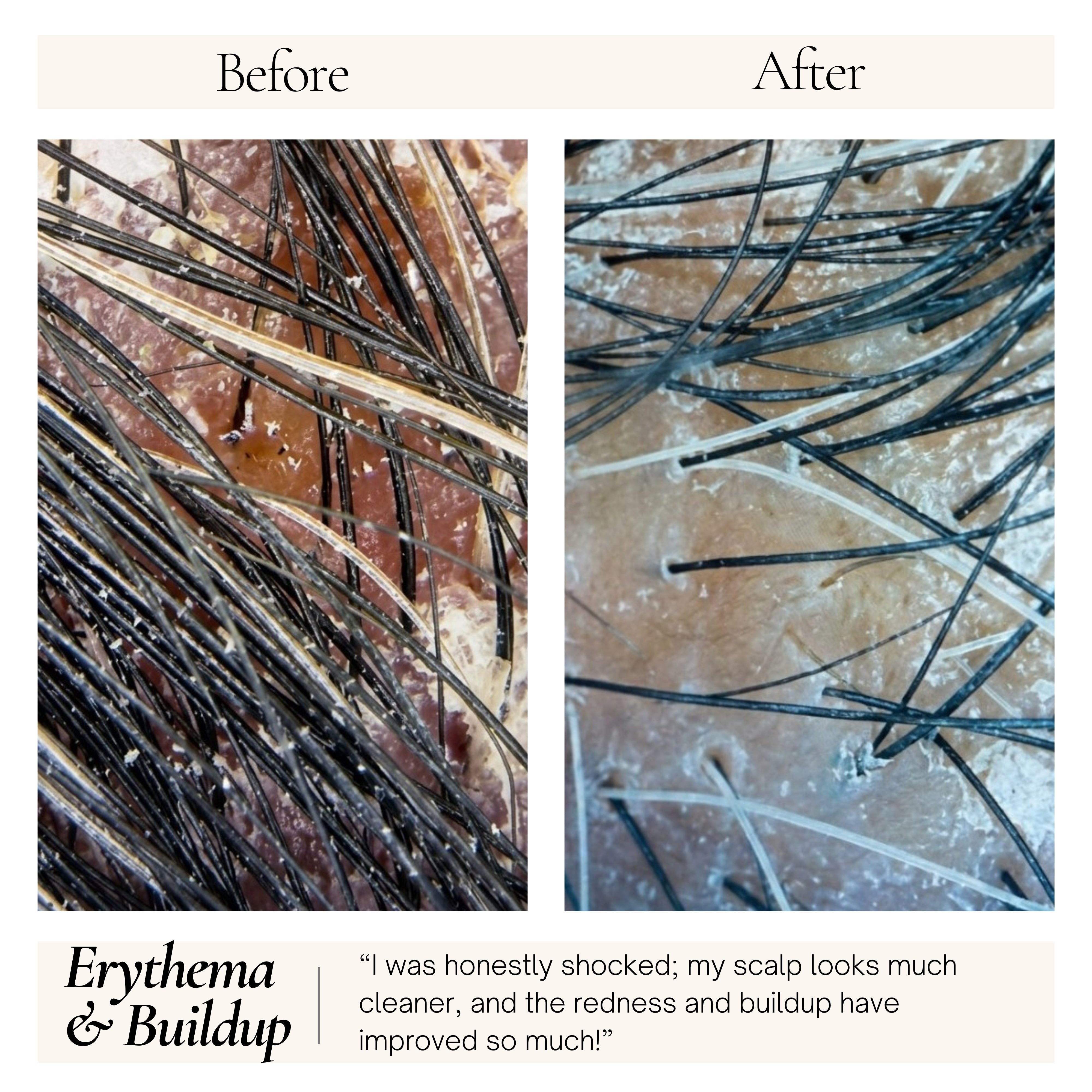 RootVeda Oil