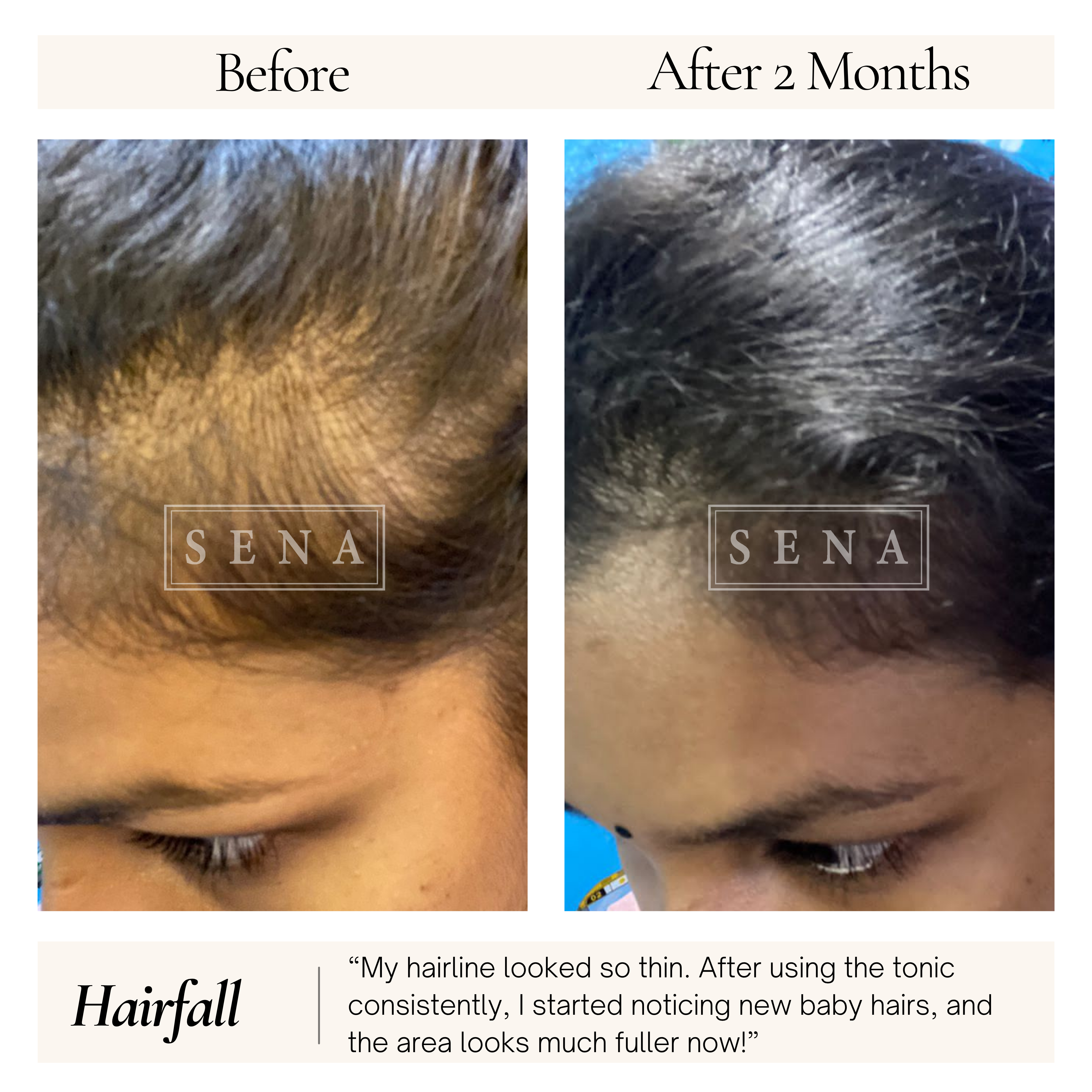 RootRecovery Tonic