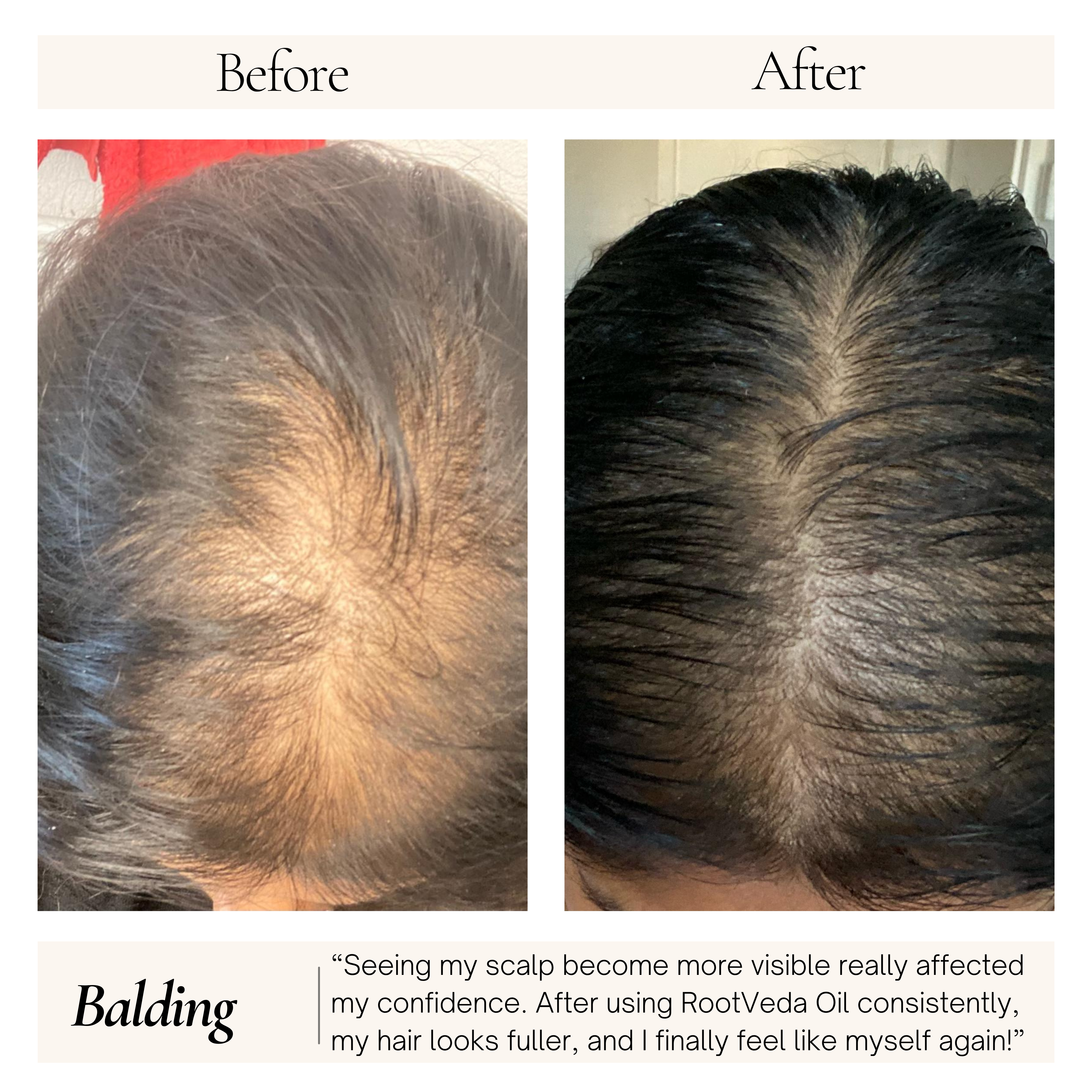RootVeda Oil