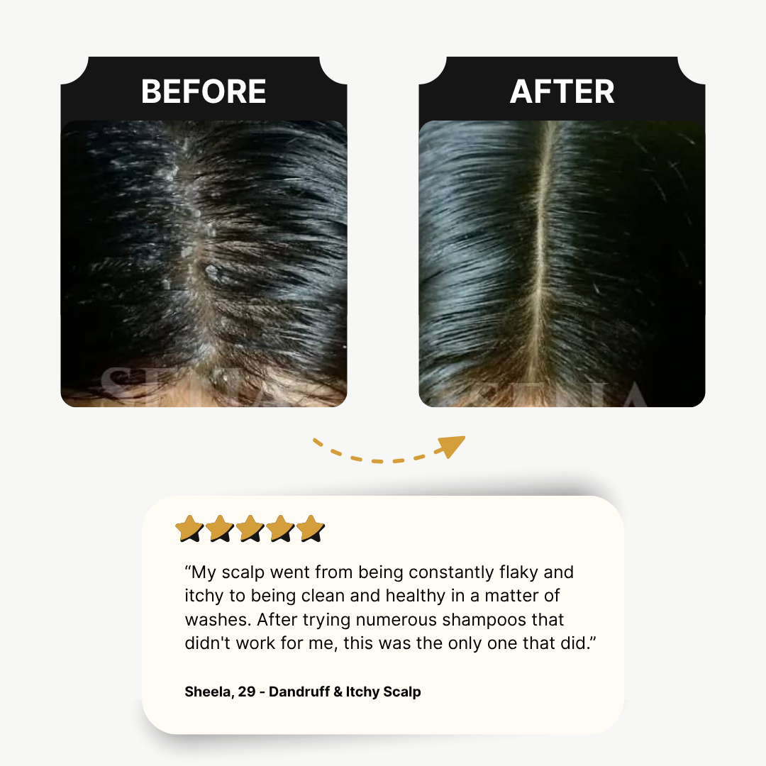RootGuard Shampoo | Oily Scalp Shampoo | FULL GROWTH CYCLE