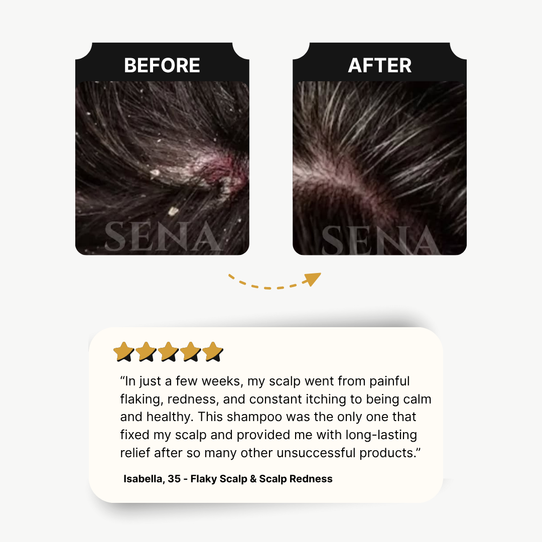 RootGuard Shampoo | Oily Scalp Shampoo | FULL GROWTH CYCLE